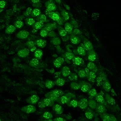 Immunohistochemical Detection of 53BP1 in Frozen Mouse Ganglion Cells