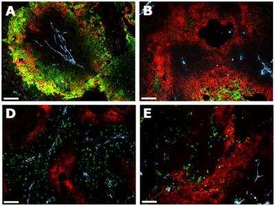 Immunohistological Detection of Carbonic Anhydrase IX/CA9 in SCCNij202 Tumors in Mice