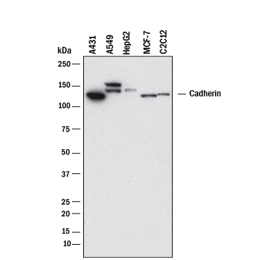 Detection of Human and Mouse Cadherin antibody by Western Blot.