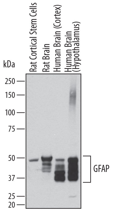 Detection of Human and Rat GFAP antibody by Western Blot.