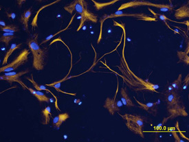 GFAP antibody in Rat Cortical Stem Cells by Immunocytochemistry (ICC).