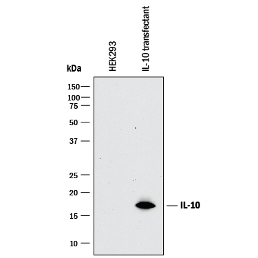 Detection of IL-10 antibody by Western Blot.