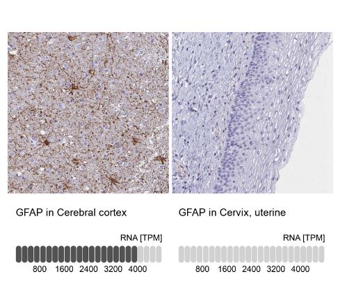 GFAP Antibody