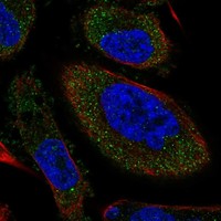 Immunocytochemistry/Immunofluorescence: Tyrosine Hydroxylase Antibody [NBP3-21234] -